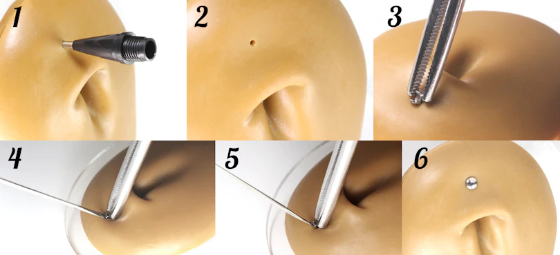 Dermal anchor assistant tool